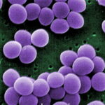 Staphylococcus-aureus-common-on-human-skin-WikiCommons